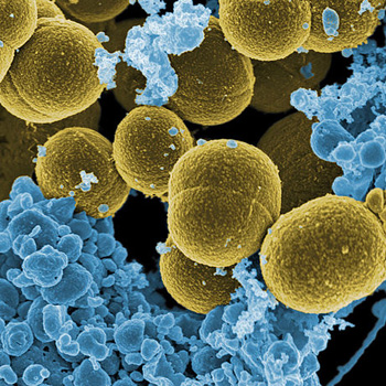 Bacteria