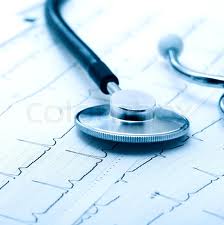 ECG