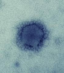 MERS1