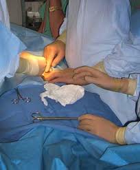 Surgery