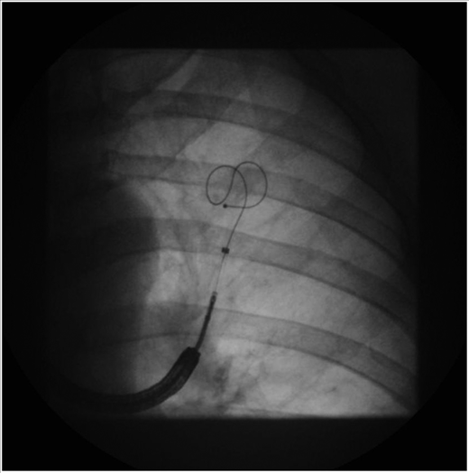 m_574fig02