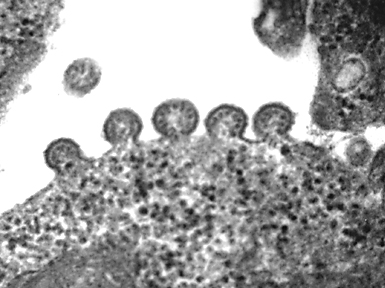 rsvirus