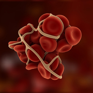 thrombolysis